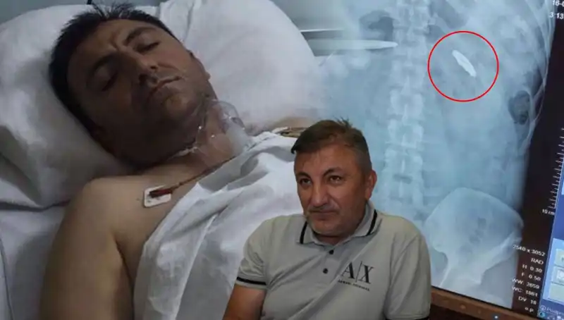 15 Temmuz’da Yaralanan Gazi, 9 Yıldır Vücudundaki Kurşunla Yaşıyor