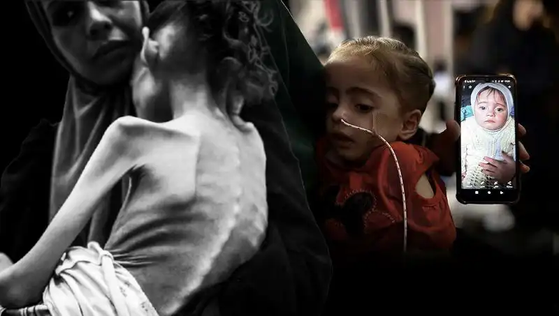 Küçük Meryem'in Açlıkla Savaşan Mücadelesi: 25 Kilodan 10 Kiloya Düştü