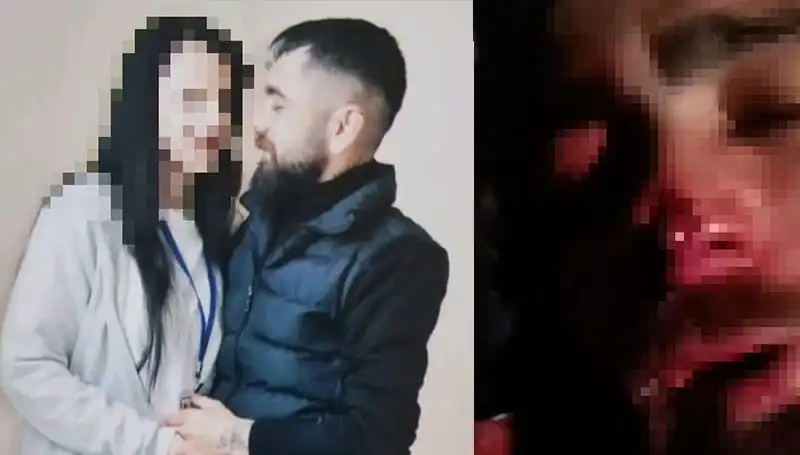 Eski Sevgiliye Uygulanan Dehşet Verici İşkence Olayı: Abisi Tarafından Kulağı ve Burnu Koparıldı